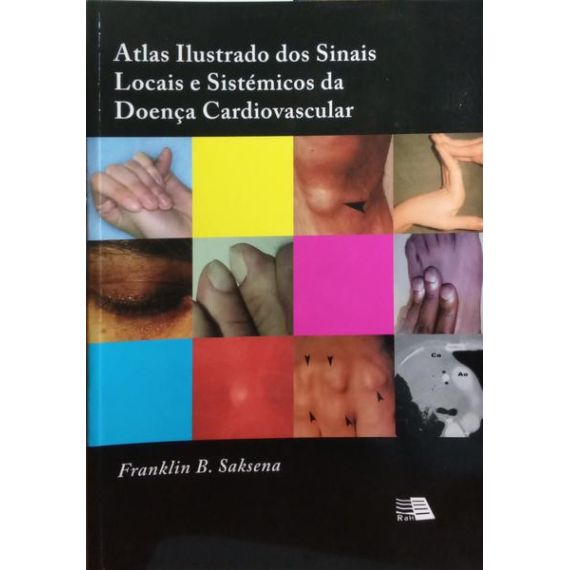 ATLAS ILUSTRADO DE LOS SIGNOS LOCALES Y SISTÉMICOS EN LA ENFERMEDAD CARDIOVASCULAR.