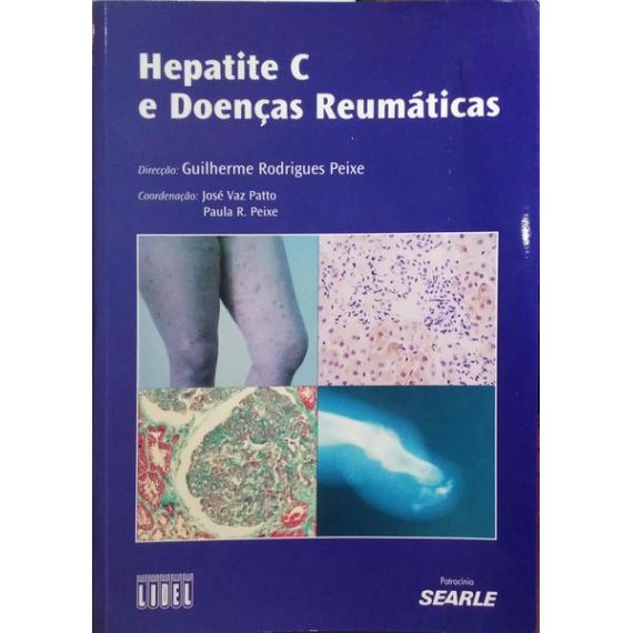 HEPATITIS C Y ENFERMEDADES REUMÁTICAS.